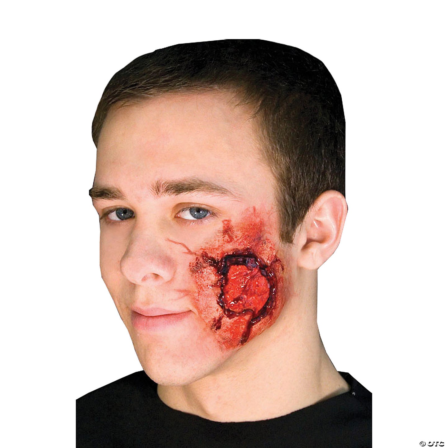 OPEN WOUND PROSTHETIC